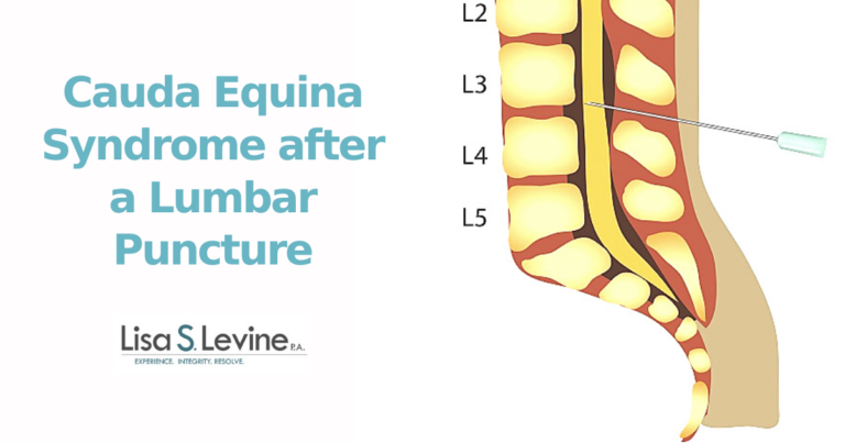 Cauda Equina Syndrome after a Lumbar Puncture