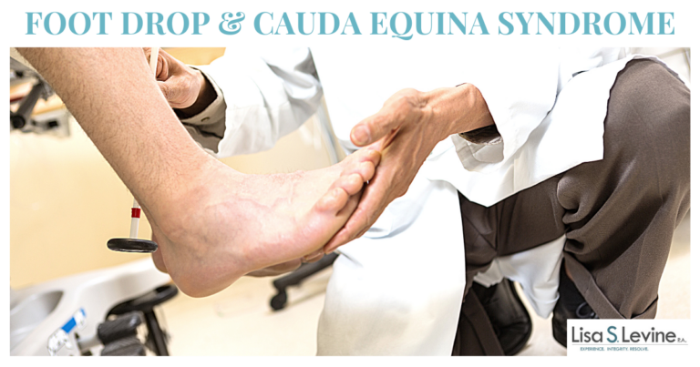 FOOT DROP & cauda equina syndrome - Levine Florida