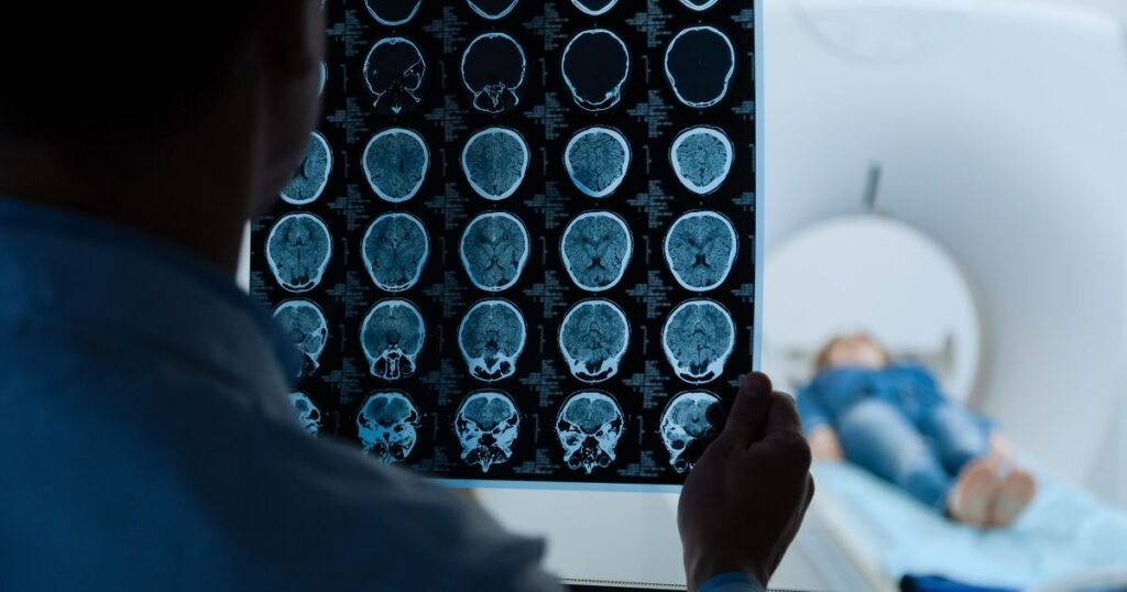 Delayed Stroke Treatment FL